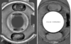 Click image for larger version

Name:	different butt-slide and butt interfaces.png
Views:	199
Size:	338.8 KB
ID:	124390